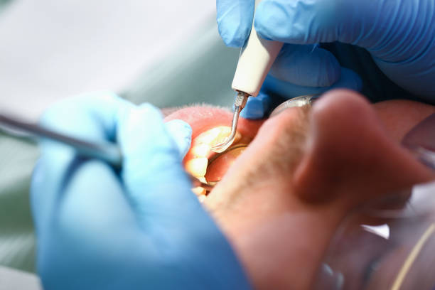 Best Emergency Tooth Extraction  in Poth, TX